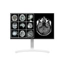 Monitor 27" lg 27hj712c-w.aeu 8mp clinical review, panel type: ips ,resolution: 3840x2160, brightness: 350cd/m2, response time: 14 ms,contrast ratio (typical): 1000:1, connectivity: hdmi(2.0) x 2, dp(1.2) x1, headphone out, 1x usb 3.0 upstream, 2x usb 3.0,  Monitoare LED | electropc.ro